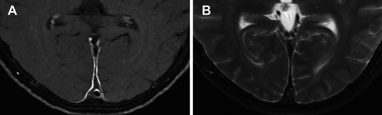 Figure 14