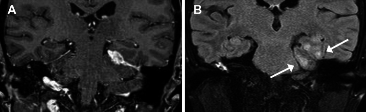 Figure 15