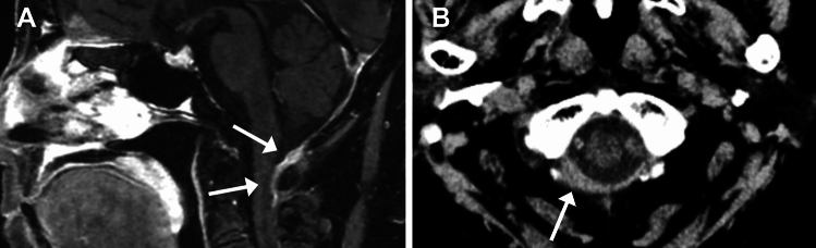 Figure 16