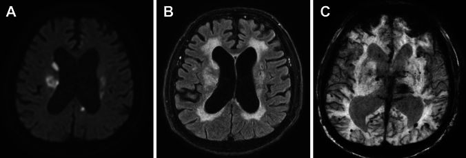 Figure 17