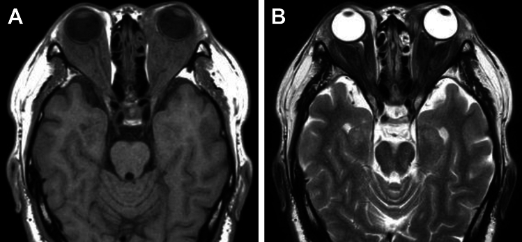 Figure 18