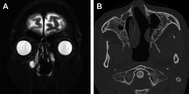 Figure 19