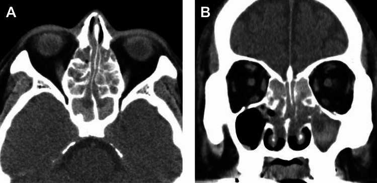 Figure 20