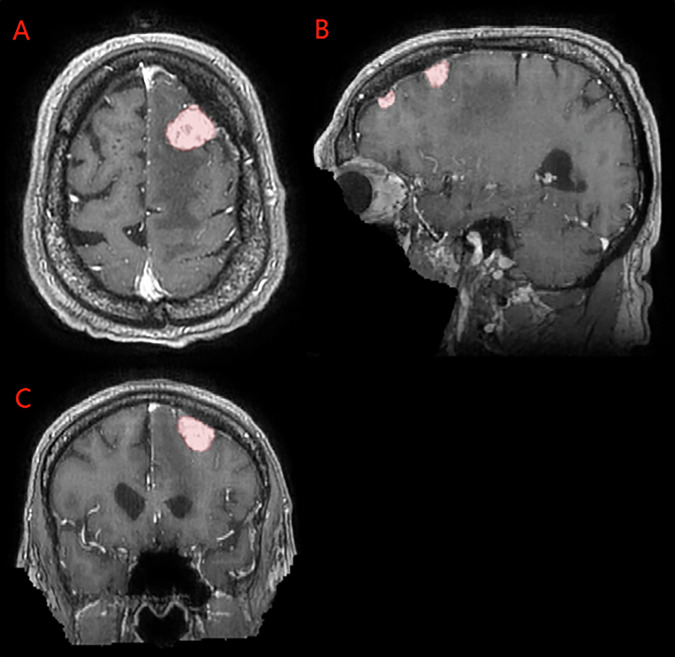 Figure 1