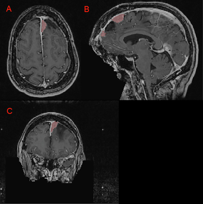 Figure 2