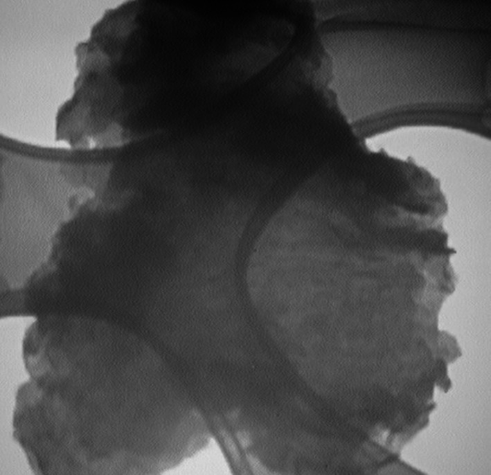 Figure 14