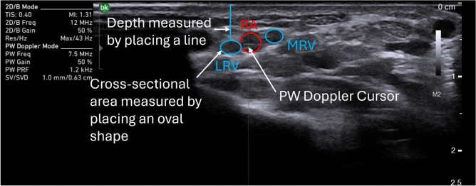 Figure 2