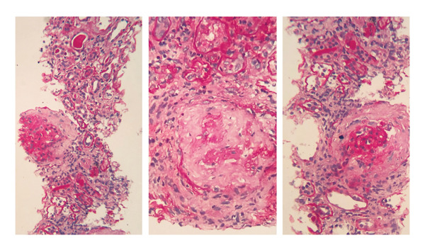 FIGURE 1