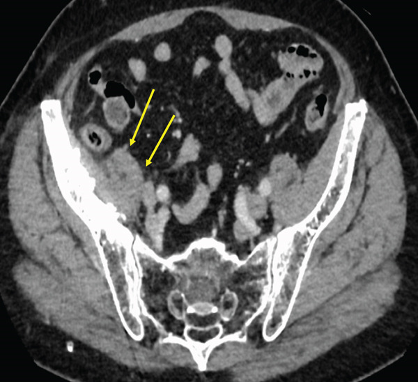 Figure 14