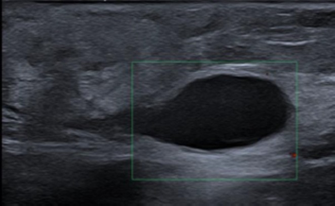 FIGURE 11