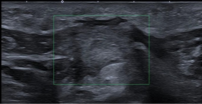 FIGURE 10