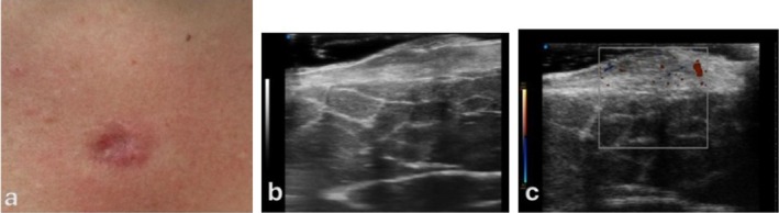 FIGURE 12