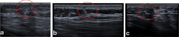 FIGURE 3