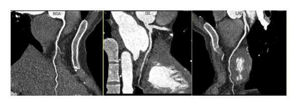 FIGURE 3