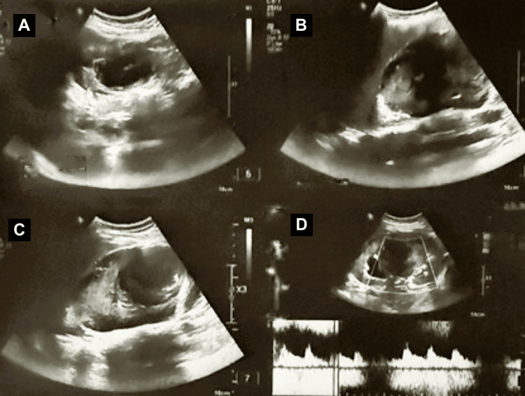 Figure 6