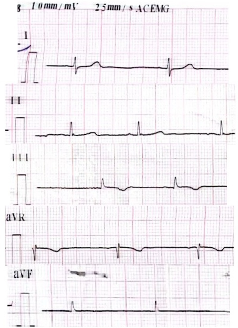 FIGURE 2