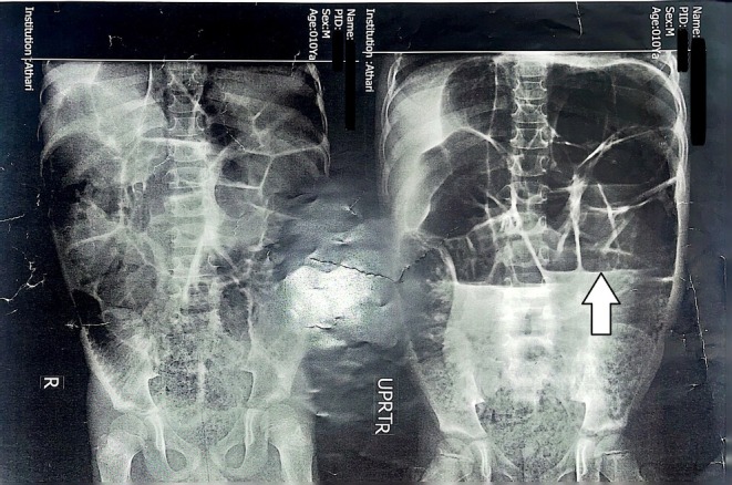 FIGURE 1