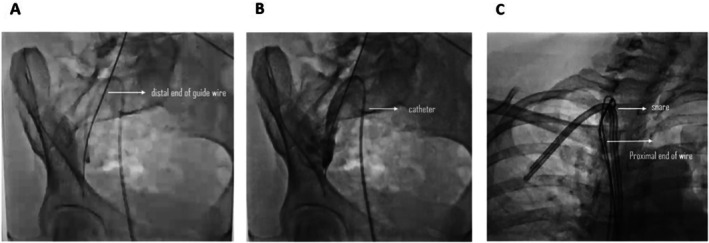 FIGURE 1
