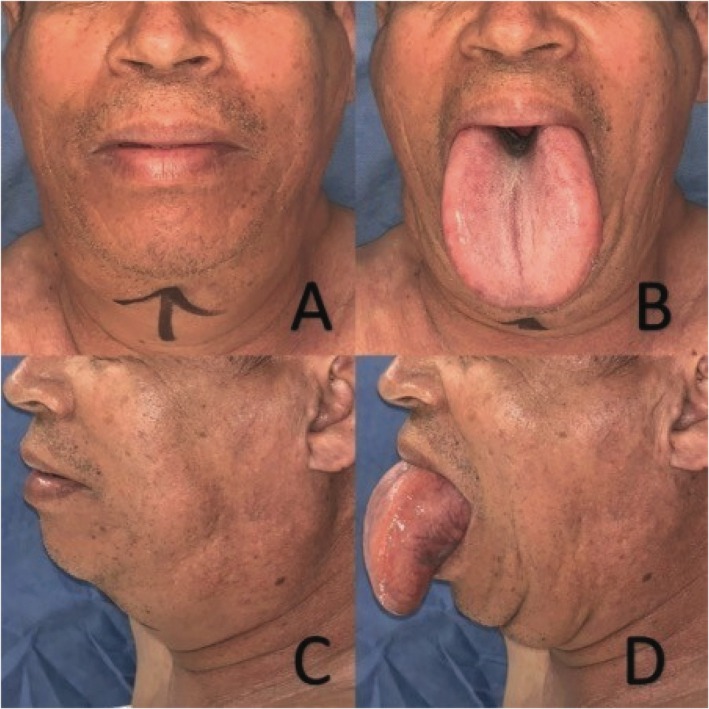 FIGURE 1