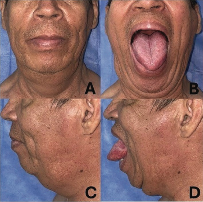 FIGURE 4