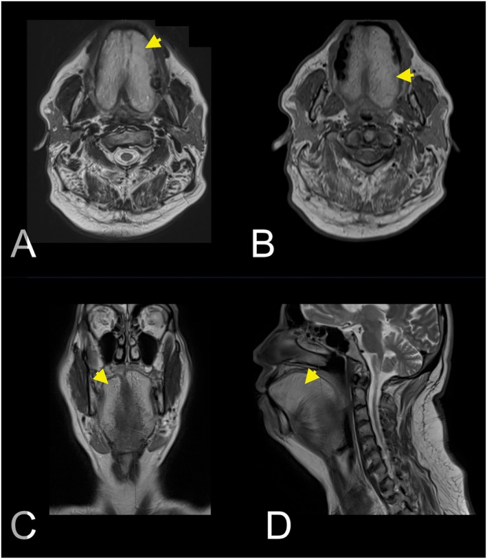 FIGURE 2