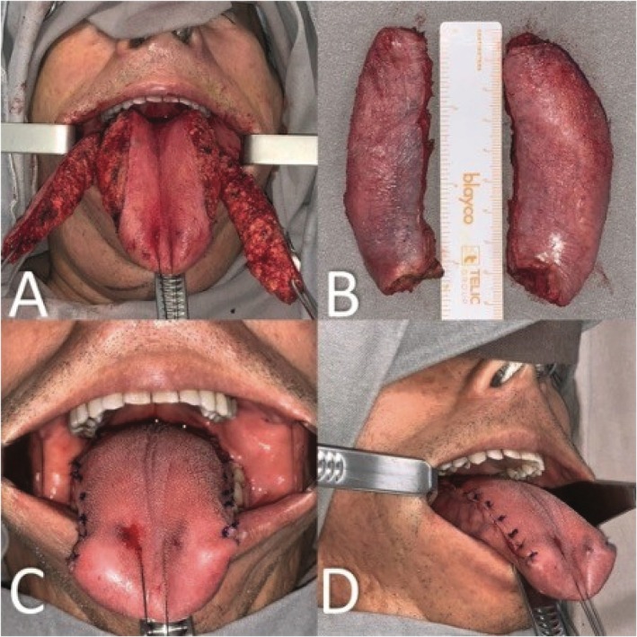 FIGURE 3