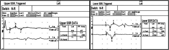 FIGURE 3