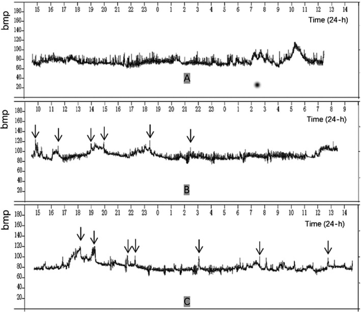 FIGURE 2