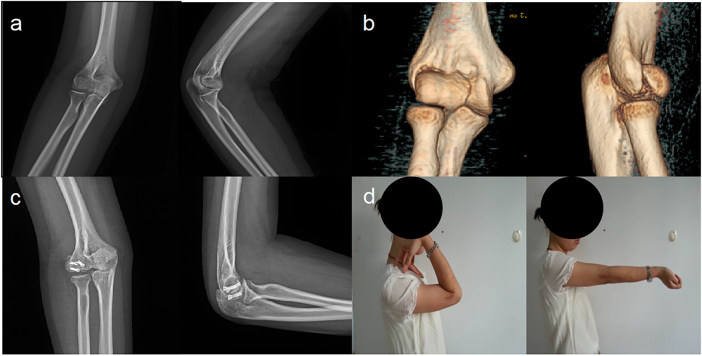 Figure 1