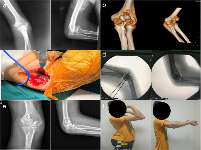 Figure 2