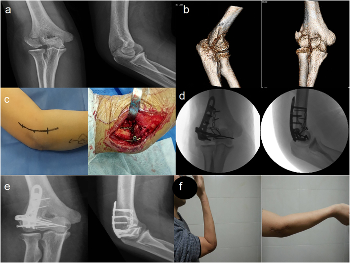Figure 3