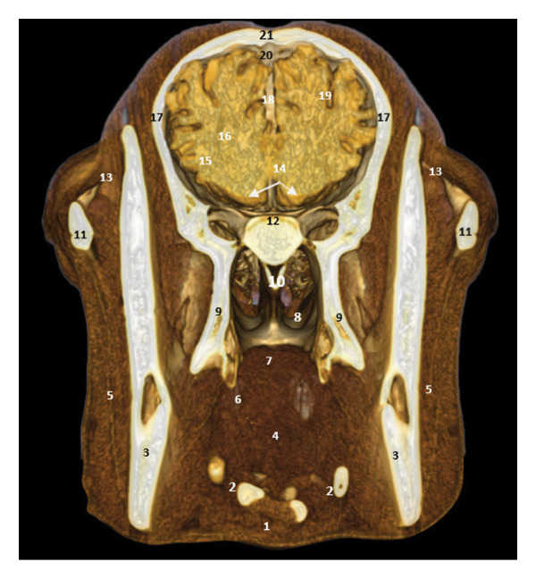 FIGURE 18