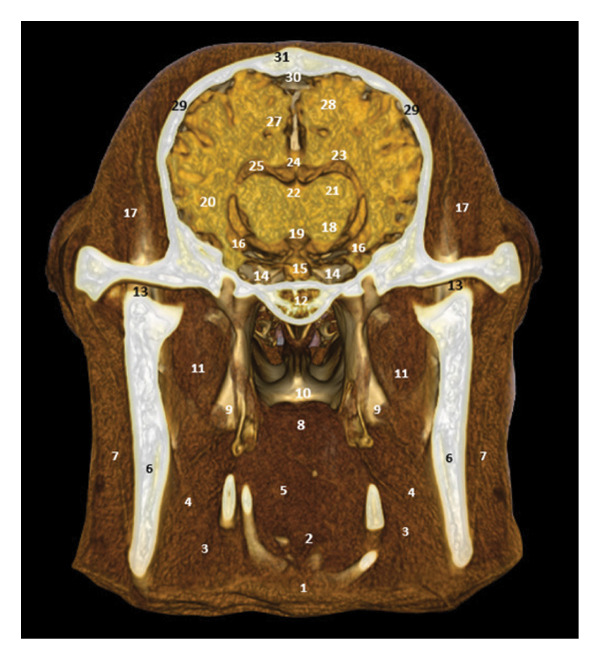 FIGURE 19