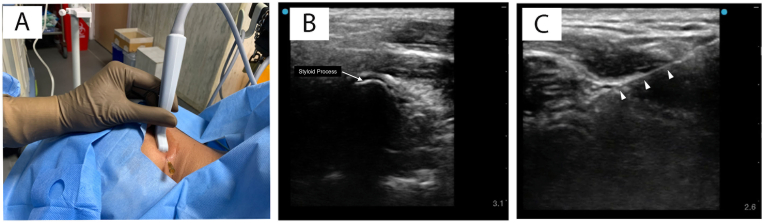 Figure 2