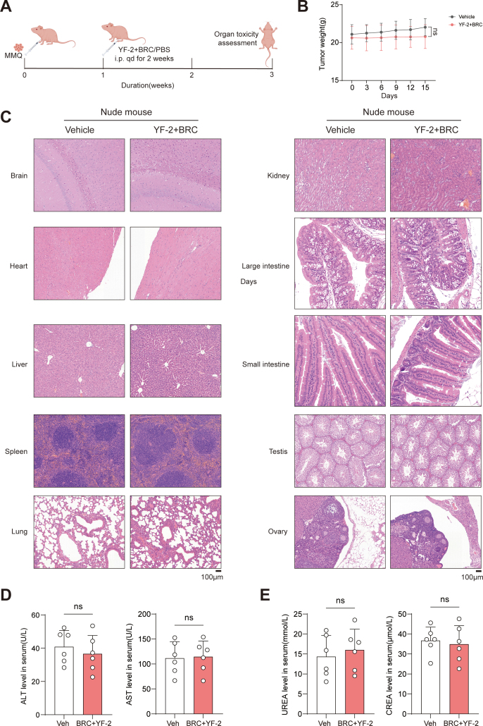 Figure 14