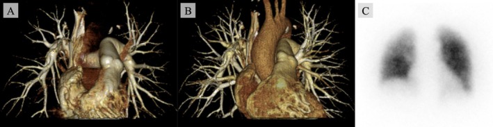 FIGURE 3