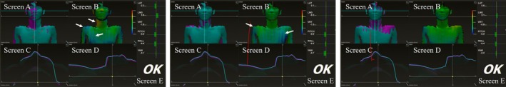 FIGURE 4