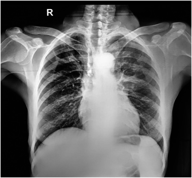 FIGURE 1