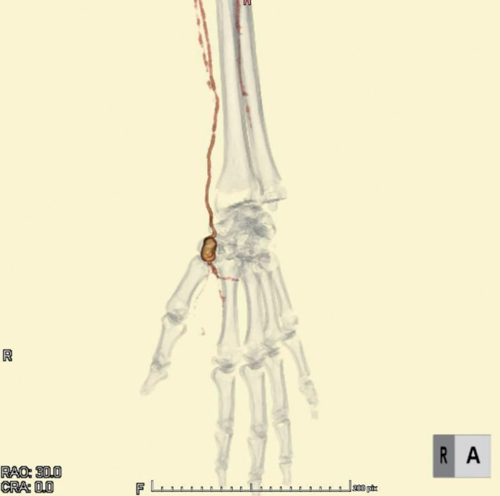 Fig. 2