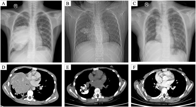 Figure 1