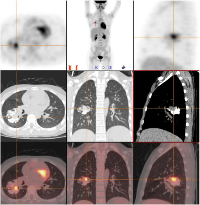 Figure 3