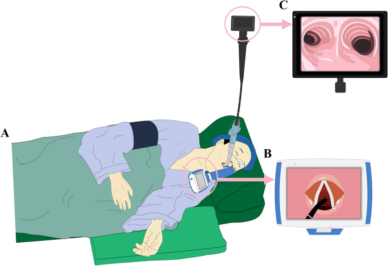 Figure 3