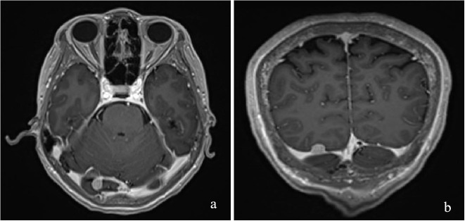 Figure 2