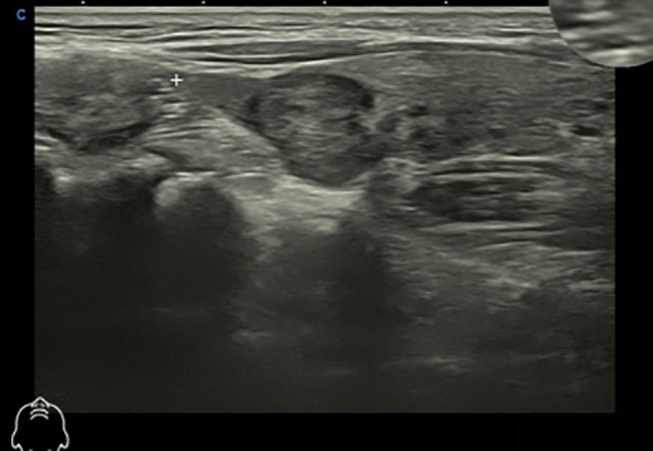Figure 3