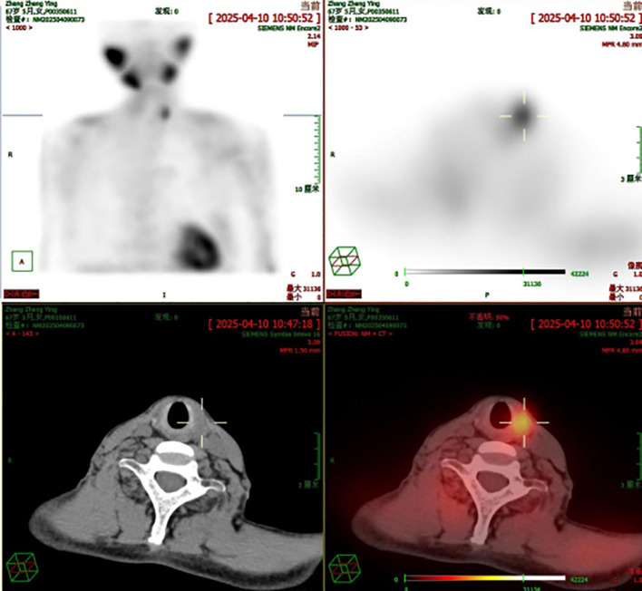 Figure 4