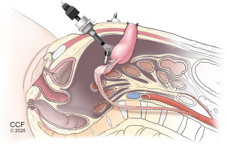 Figure 3