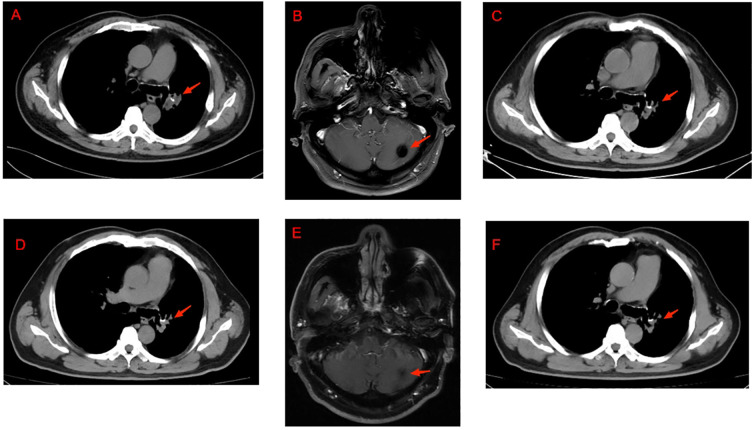 Figure 1