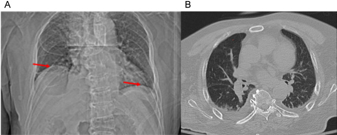 FIGURE 2