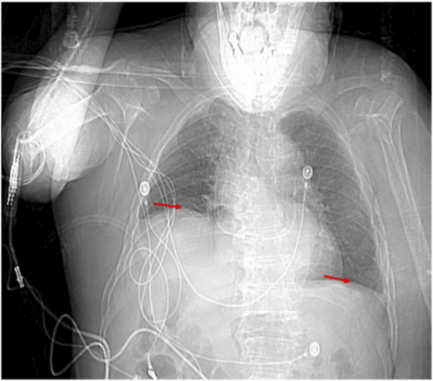 FIGURE 3