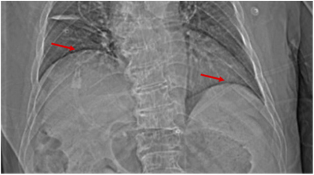 FIGURE 4
